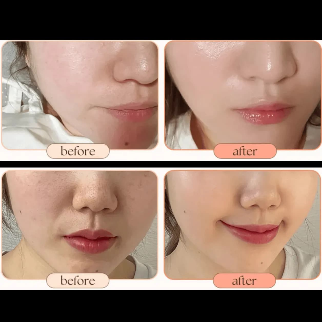 Product gallery photo 1